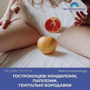 ГОСТРОКІНЦЕВІ КОНДИЛОМИ, ПАПІЛОМИ, ГЕНІТАЛЬНІ БОРОДАВКИ