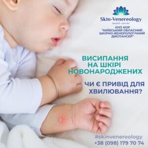 ВИСИПАННЯ НА ШКІРІ НОВОНАРОДЖЕНИХ. ЧИ Є ПРИВІД ДЛЯ ХВИЛЮВАННЯ?